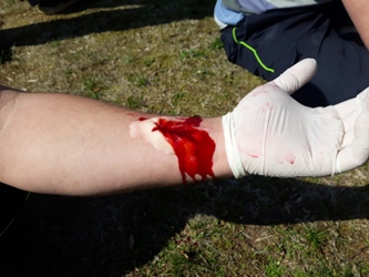 15. Základy první pomoci