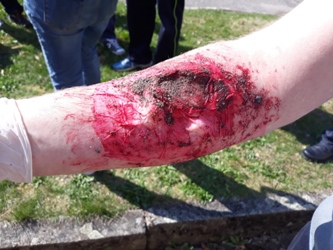 17. Základy první pomoci